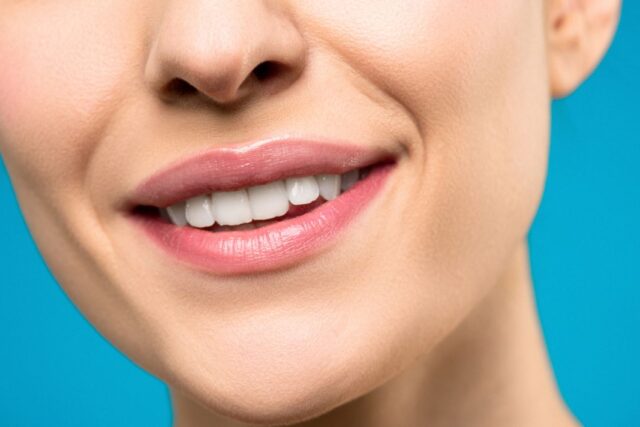 Albirea dentară profesională vs. produsele de acasă: diferențe reale